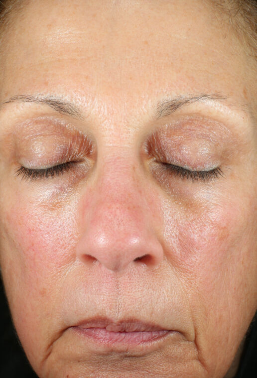 Renewal Crème and Recovery Crème | Product Innovation